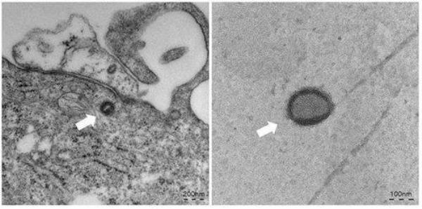 This file photo, provided by the Korea Disease Co<em></em>ntrol and Prevention Agency on Aug. 17, 2022, shows the mpox virus. (PHOTO NOT FOR SALE) (Yonhap)