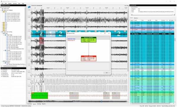 This image provided by Ho<em></em>neyNaps Co. shows its sleep sensing algorithm, Somnum. (PHOTO NOT FOR SALE) (Yonhap)